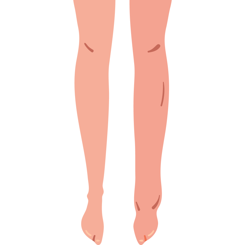 Legs showing slight swelling around the ankles. Legs showing slight swelling around the ankles.